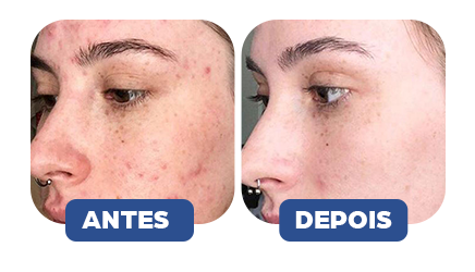 Antes e depois - Resultado 2